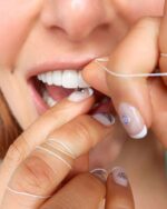 FLOSS - Image 6